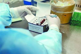 山东18个流感实验室可测H7N9 监测未发现异常